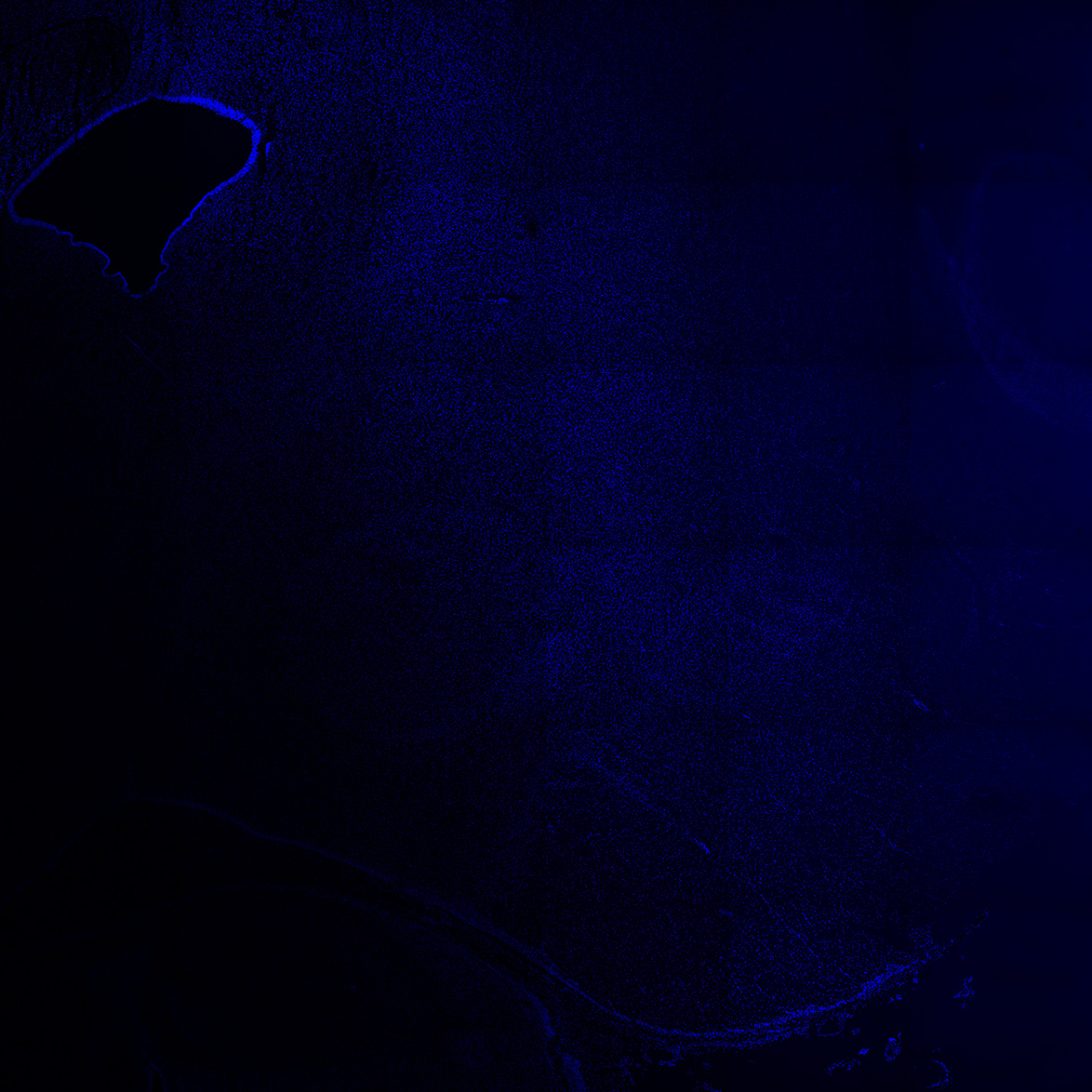 Human foetal midbrain